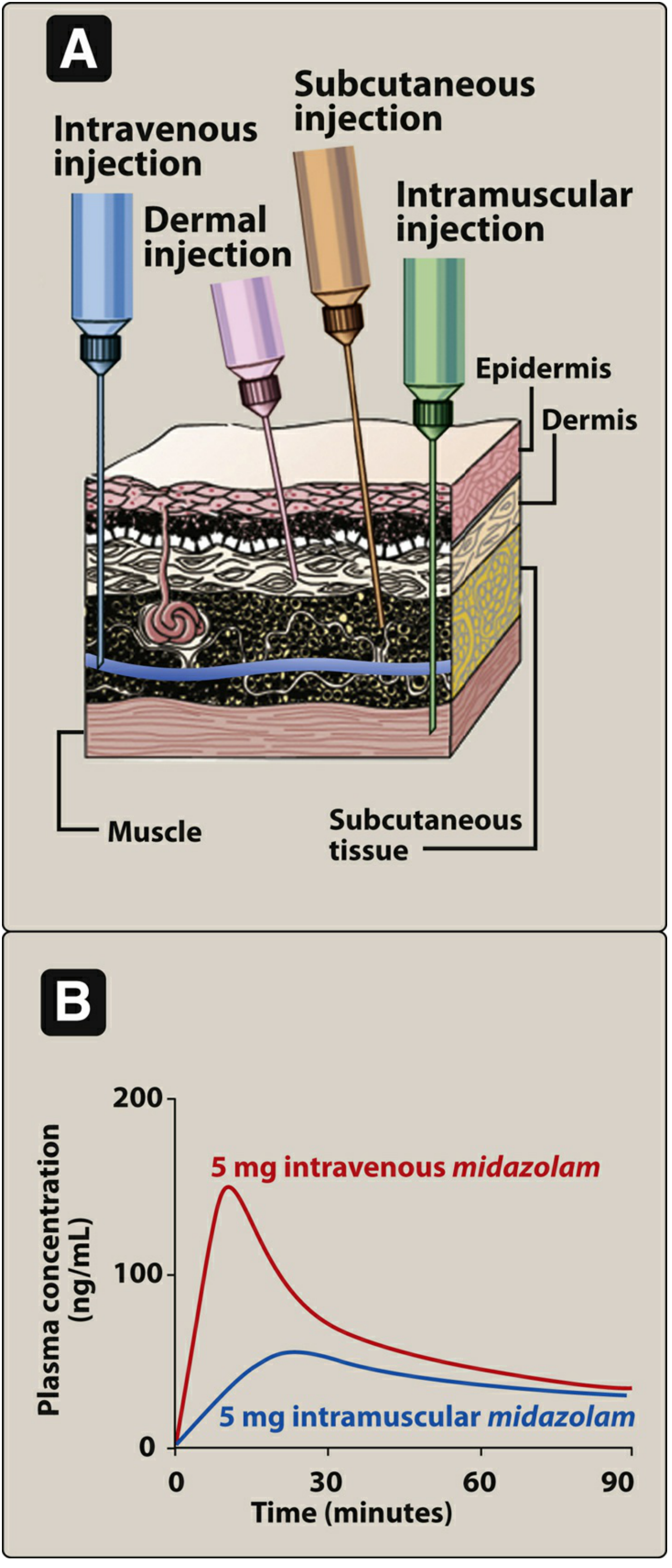 Schematic of injection methods and plasma concentrations