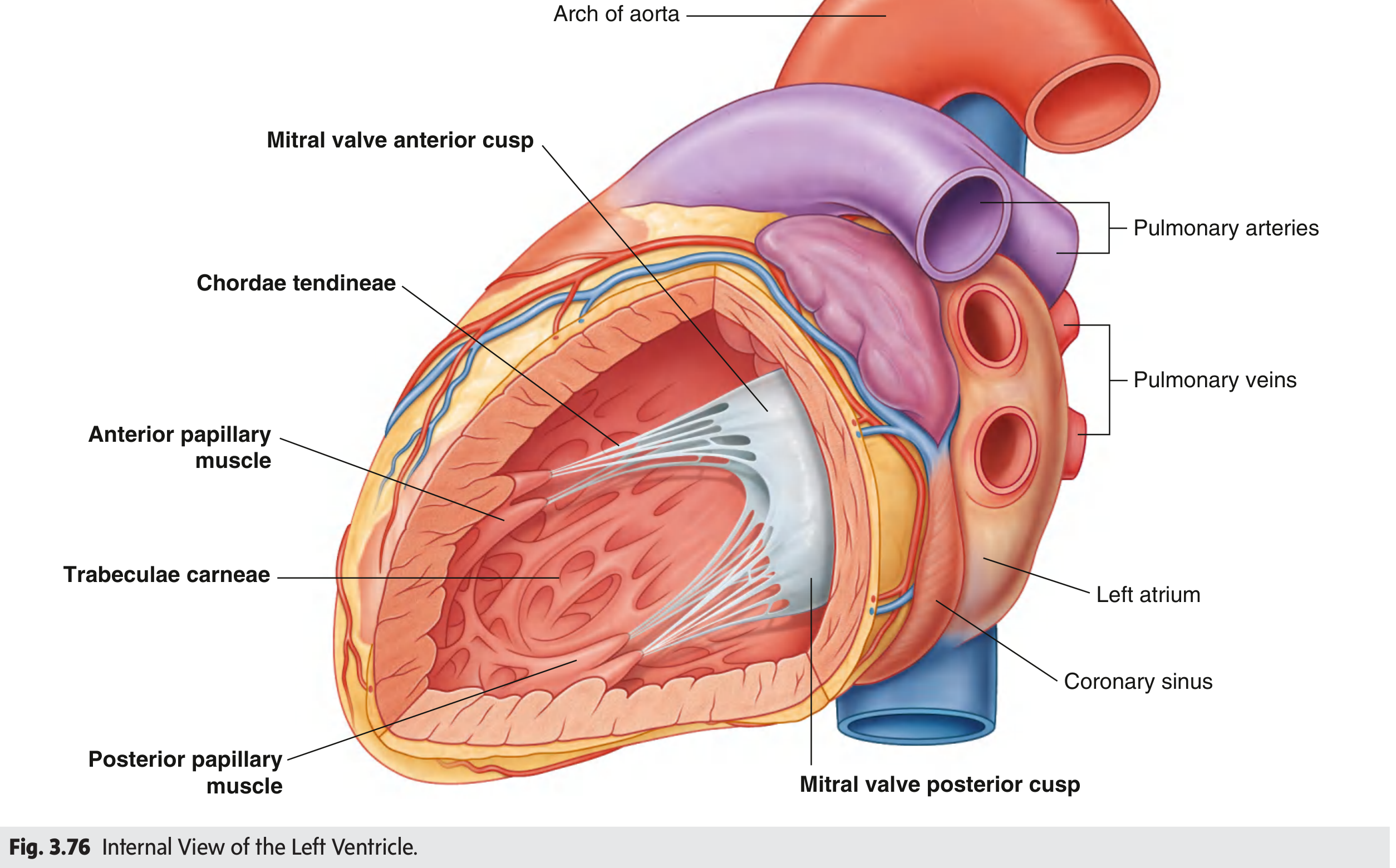 Internal view of the left ventricle showing mitral valve, papillary muscles, and trabeculae carneae