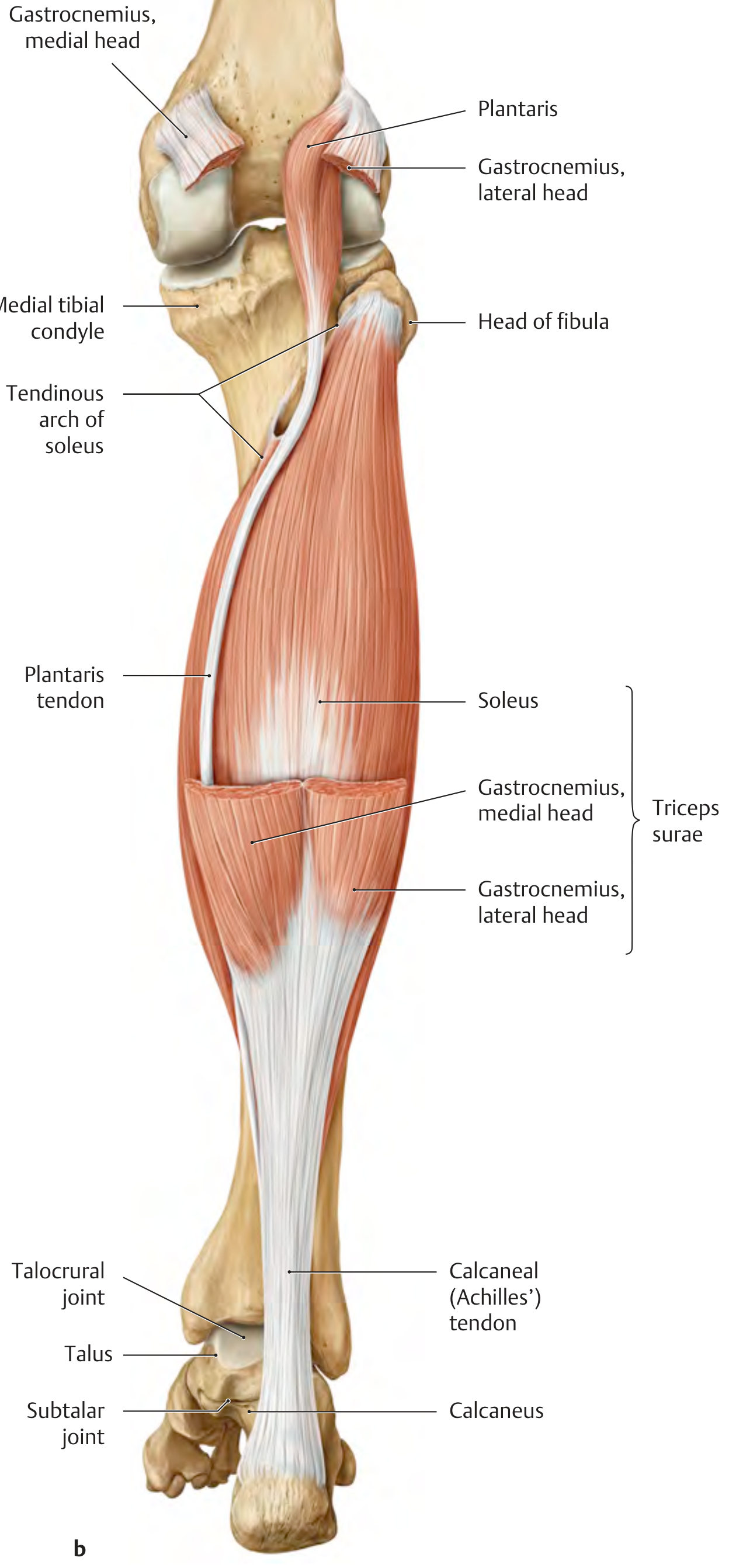 Triceps surae - posterior view showing gastrocnemius heads, soleus, and Achilles tendon