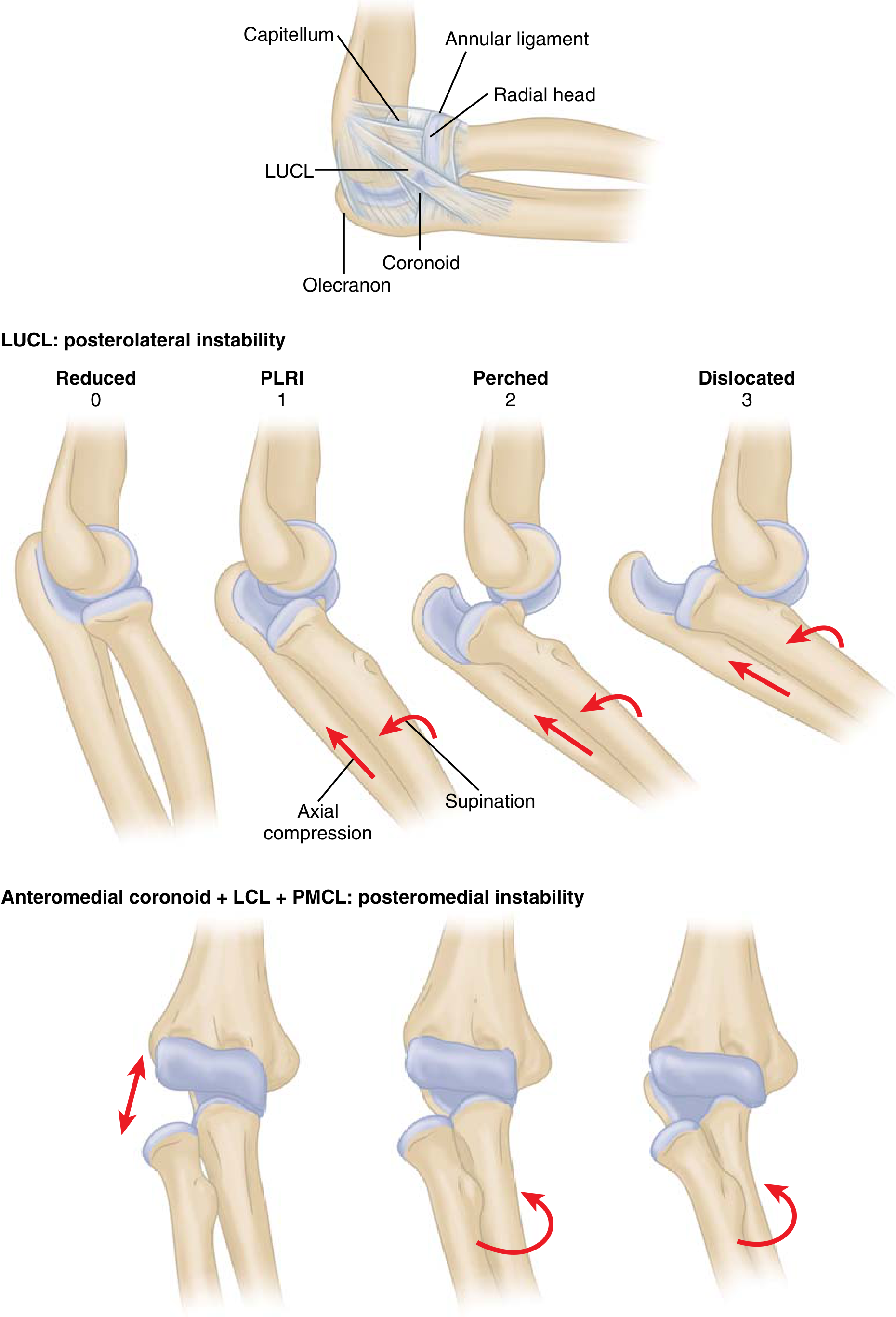 Elbow Stabilizers and Instability Patterns