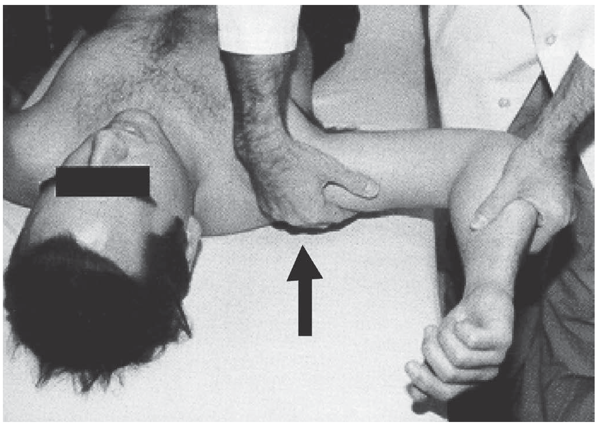 Apprehension test for anterior shoulder instability - patient supine, arm abducted with external rotation producing sense of impending dislocation