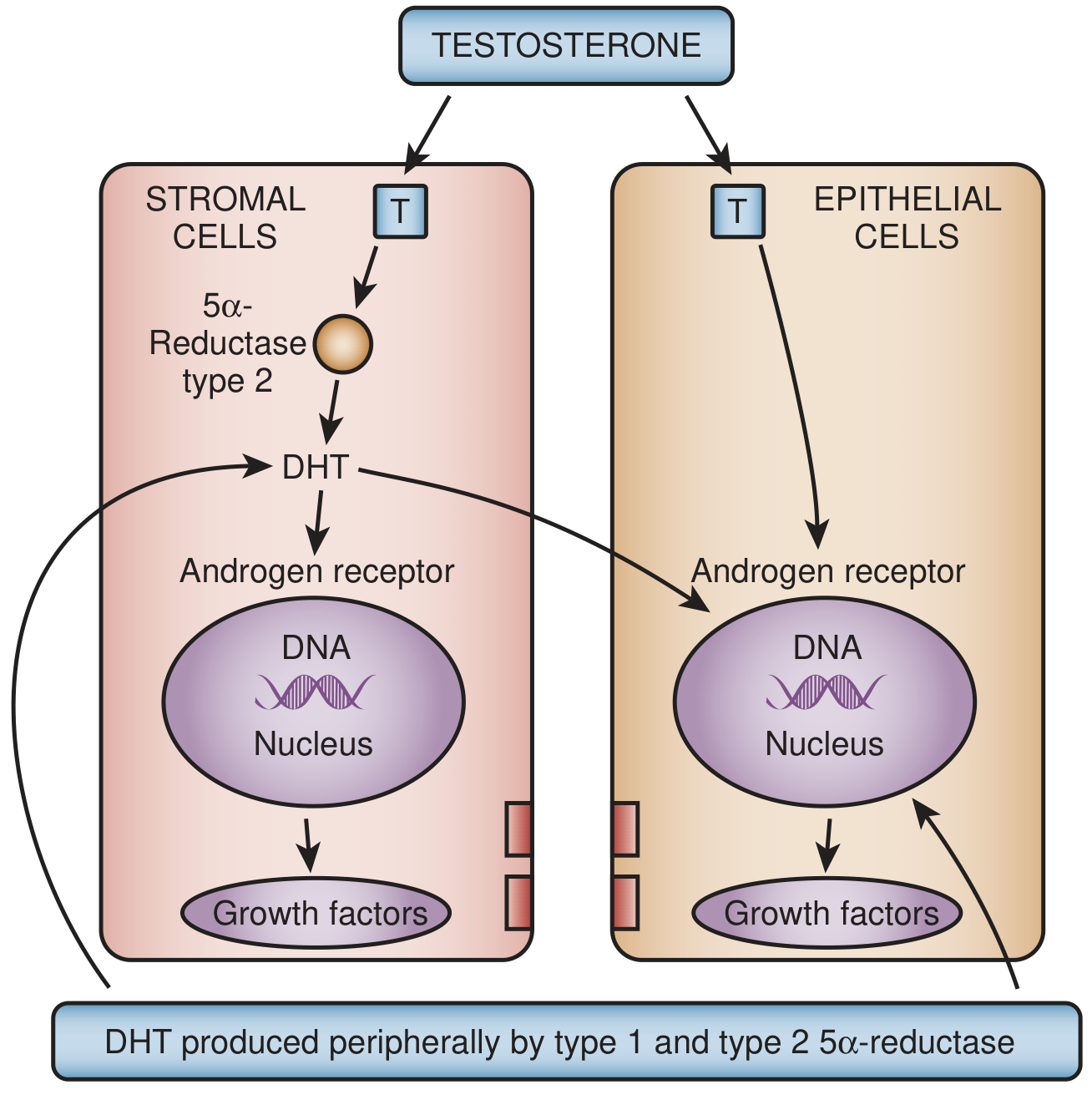 Paracrine DHT model: Testosterone enters both stromal and epithelial cells. In stromal cells, 5α-reductase type 2 converts testosterone to DHT, which activates androgen receptors and triggers growth factor production that acts on adjacent epithelial cells. Peripheral DHT produced by type 1 and type 2 5α-reductase also acts in an endocrine fashion.