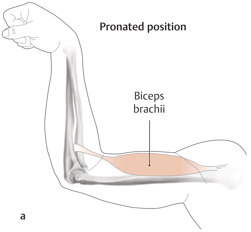 Biceps brachii in pronated position showing supination mechanism - THIEME Atlas