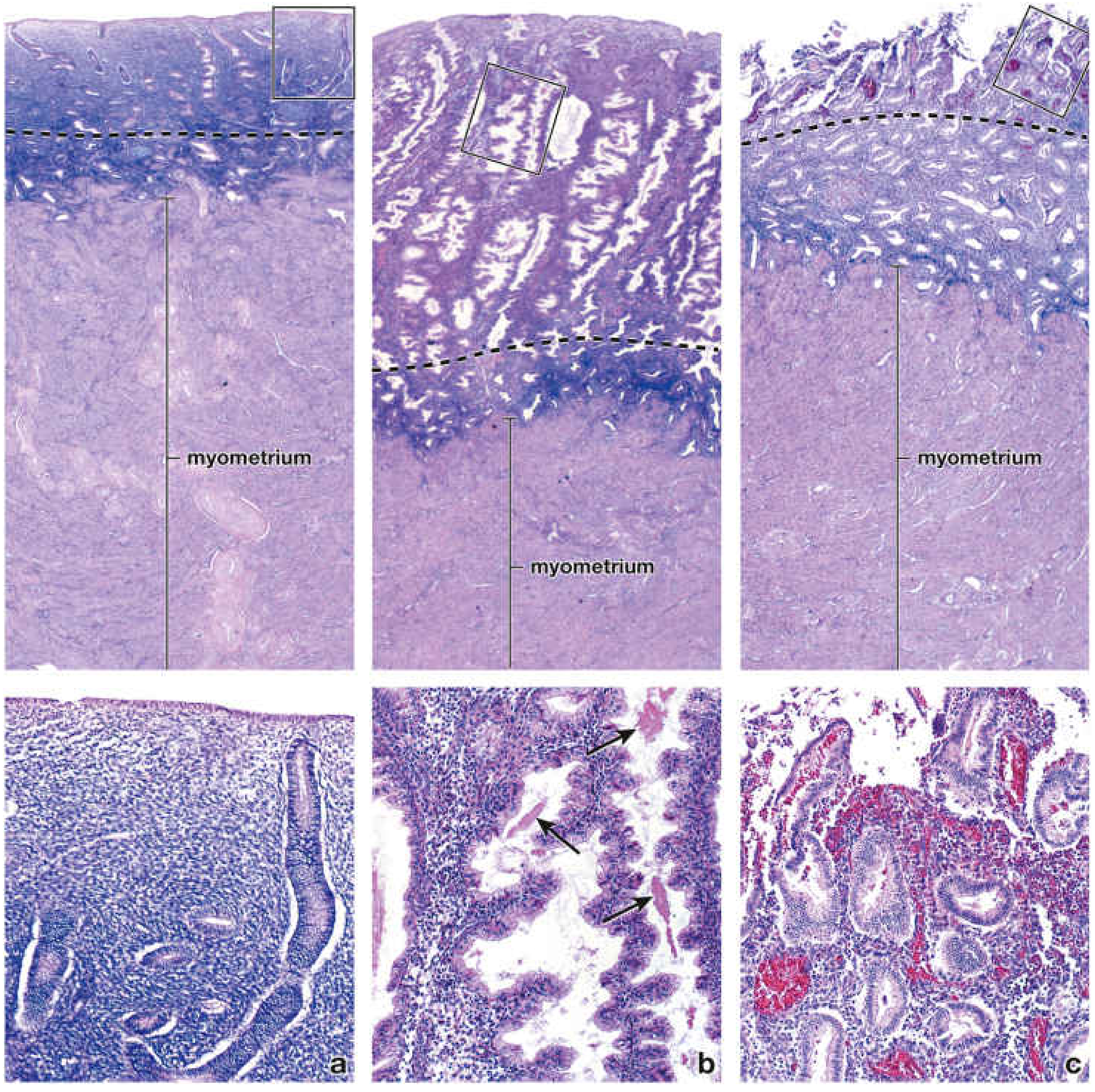 H&E photomicrographs of all three phases — proliferative (a), secretory (b), and menstrual (c)