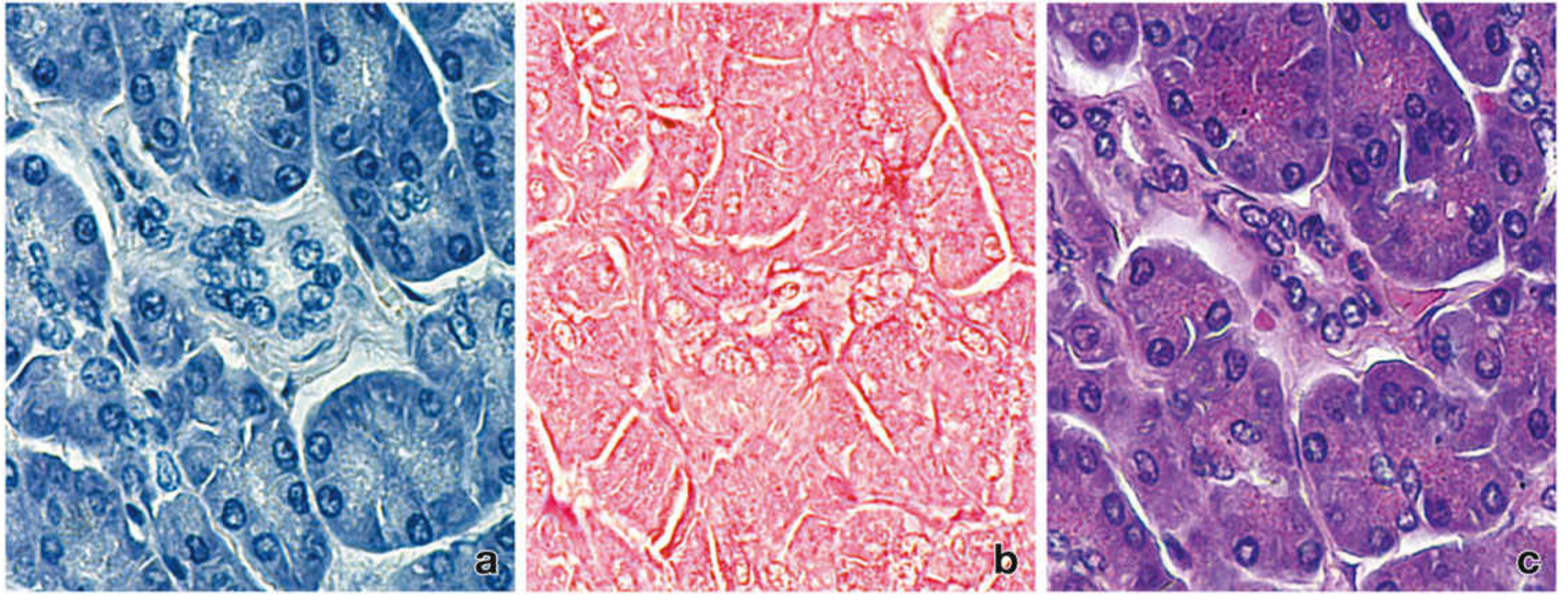 H&E staining - a) Hematoxylin only (blue), b) Eosin only (pink), c) H&E combined