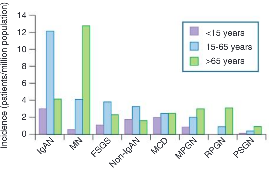 Epidemiology of Biopsy-Proven Primary Glomerulonephritis by Age — bar chart showing incidence of IgAN, MN, FSGS, MCD, MPGN, RPGN, PSGN across <15, 15–65, and >65 year age groups