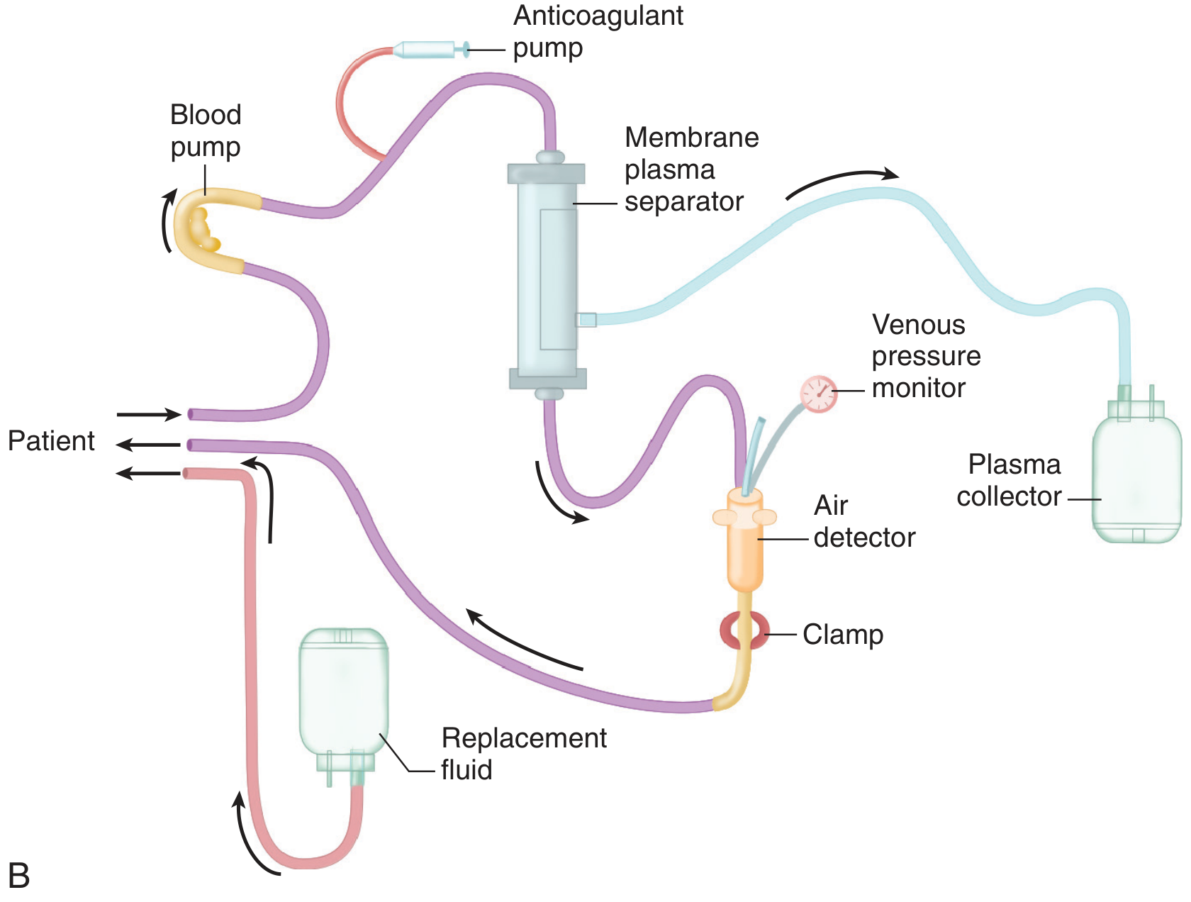 Membrane filtration (plasma separator) system for plasma exchange