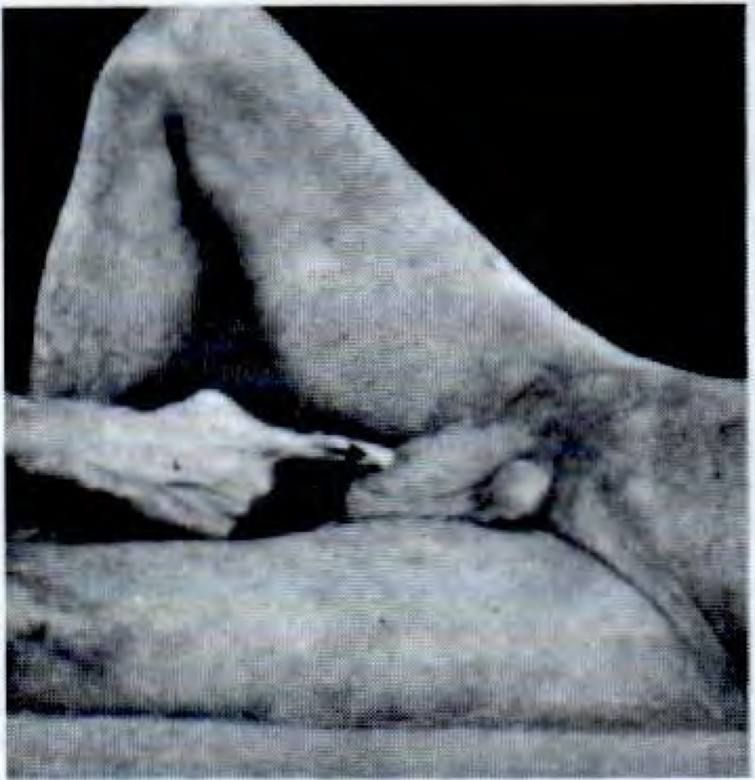 Invagination starting position