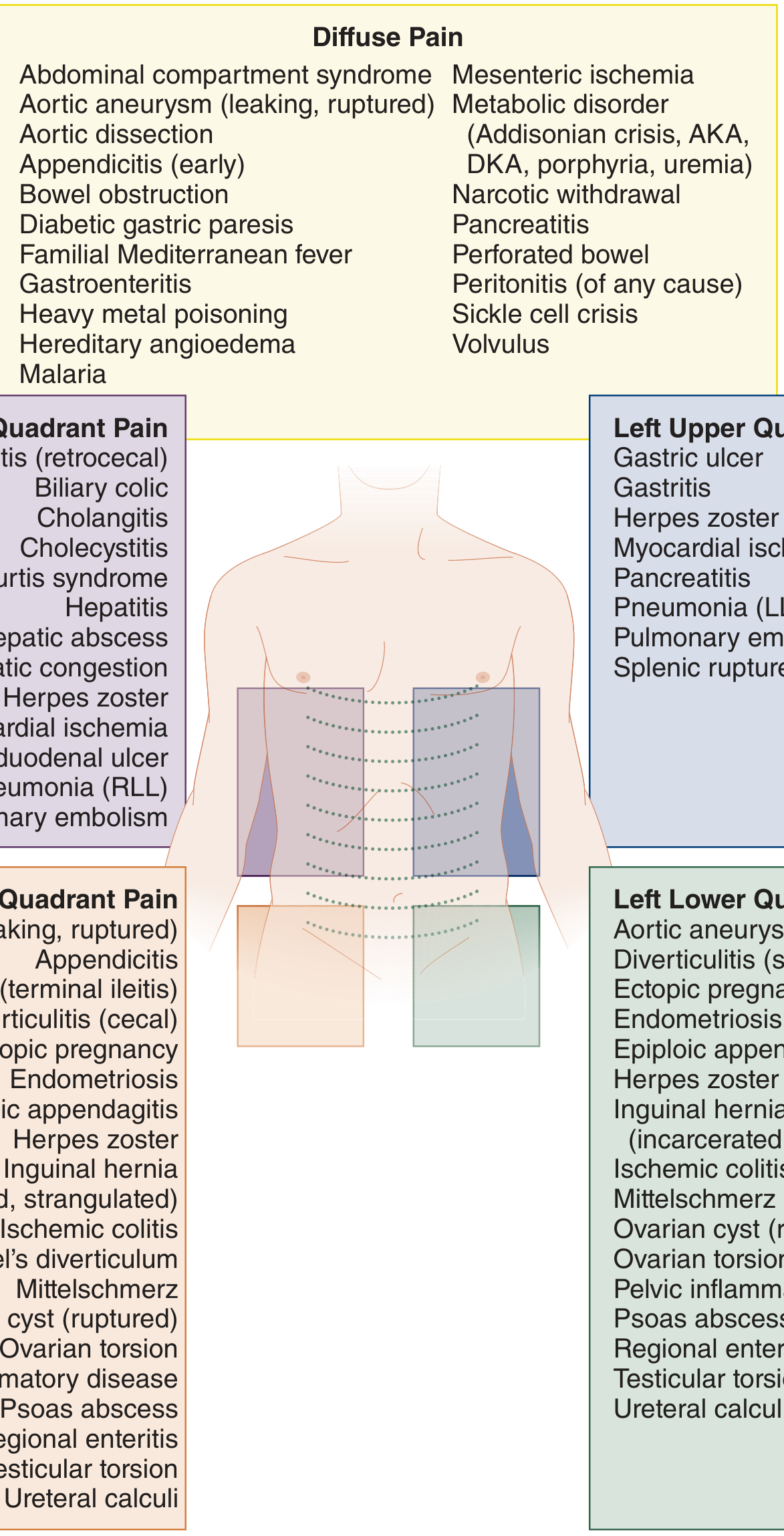 Differential Diagnosis of Acute Abdominal Pain by Location