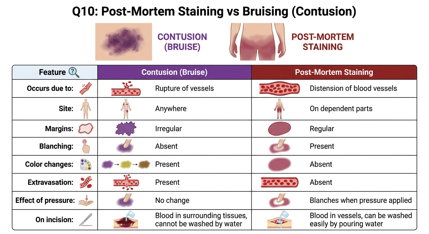 Post-Mortem Staining vs Contusion with mini diagrams