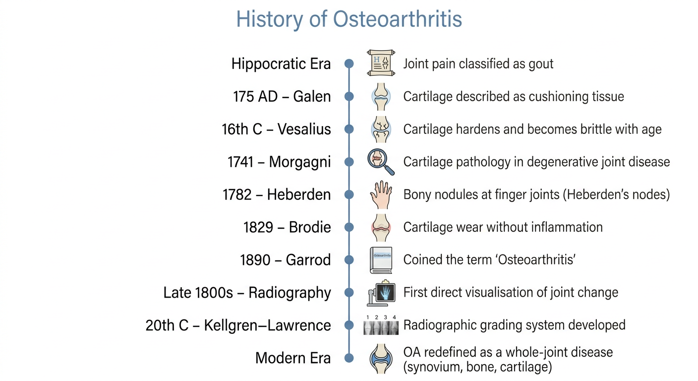 History of Osteoarthritis - Timeline