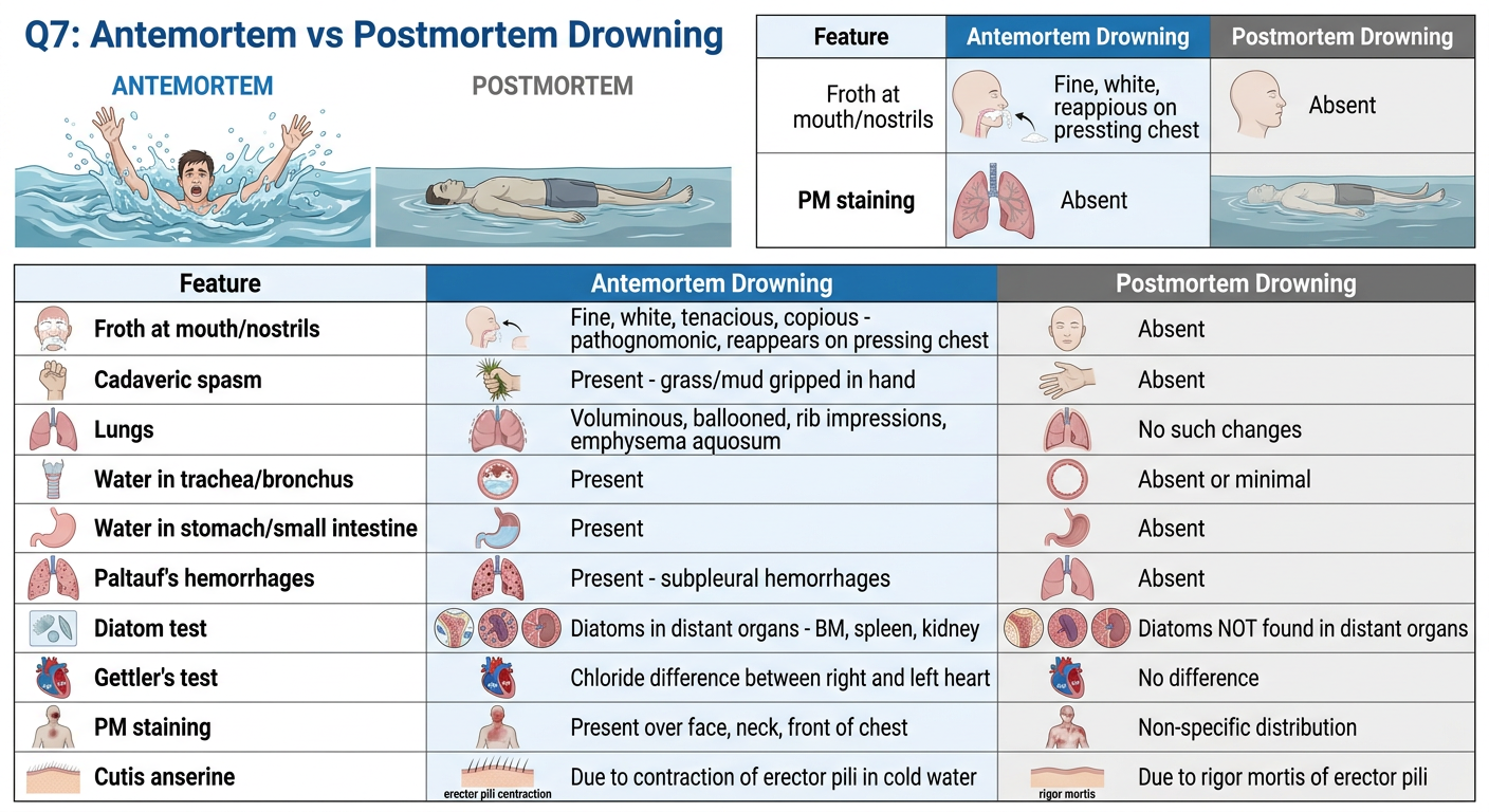 Antemortem vs Postmortem Drowning with mini diagrams